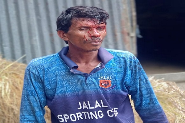 Oplus_131072 কচুয়ায় ধান কাটাকে কেন্দ্র করে হামলায় বর্গাচাষিসহ আহত ২
