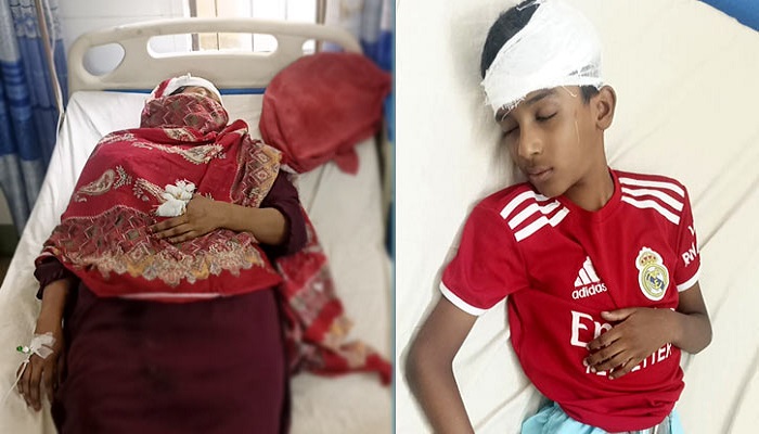 পৌরসভার ড্রেনের গ্যাস বিস্ফোরণে মা-ছেলেসহ গুরুতর আহত ৩