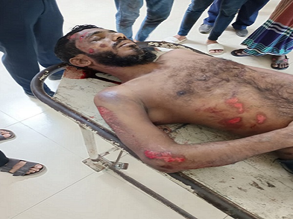 মতলবে অটোরিকশা চালককে গুলি করে হত্যা
